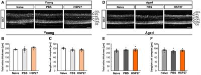 HSP27 induced glaucomatous damage in mice of young and advanced age